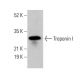 Troponin I Antibody (12) - Western Blotting - Image 376692