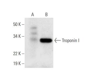 western blotting image from recommended Troponin I (E-9) monoclonal antibody replacement. Image 294590