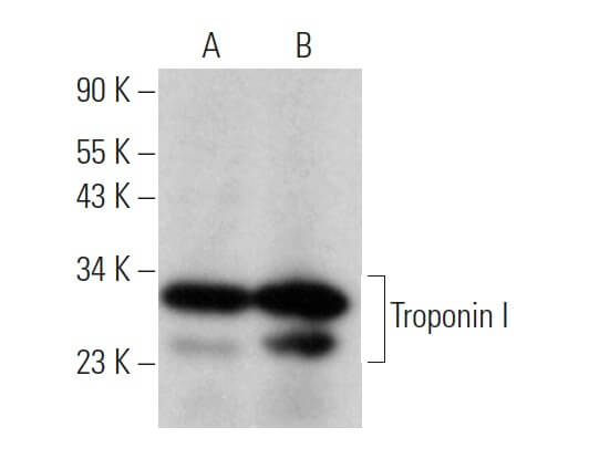Kページ Troponin I Antibody (C-4) | SCBT - Santa Cruz Biotechnology