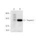 western blotting image from recommended Troponin I (E-9) monoclonal antibody replacement. Image 294590