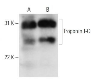 Troponin I-C Antibody (267) - Western Blotting - Image 13869
