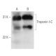 Troponin I-C Antibody (267) - Western Blotting - Image 13869