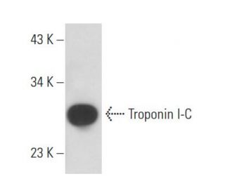 Troponin I-C Antibody (TPC-14) - Western Blotting - Image 15868