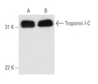 Troponin I-C Antibody (M46) - Western Blotting - Image 13872