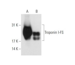 Troponin I-FS Antibody (B-7) - Western Blotting - Image 63125 