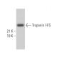 Troponin I-FS Antibody (B-7) - Western Blotting - Image 365606 