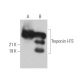 Troponin I-FS Antibody (B-7) - Western Blotting - Image 365610