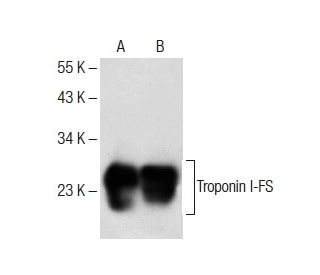 western blotting image from recommended Troponin I-FS (C-11) monoclonal antibody replacement. Image 284990