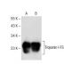western blotting image from recommended Troponin I-FS (C-11) monoclonal antibody replacement. Image 284990