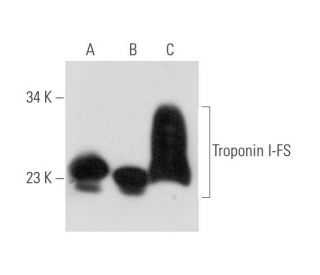 Troponin I-FS Antibody (E-1) - Western Blotting - Image 333650 