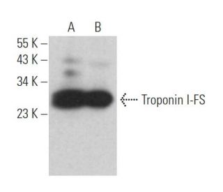 Troponin I-FS Antibody (E-2) - Western Blotting - Image 365607 