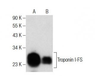 Troponin I-FS Antibody (G-7) - Western Blotting - Image 283890 