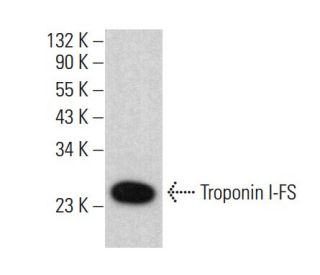 Troponin I-FS Antibody (E-1) - Western Blotting - Image 383114 
