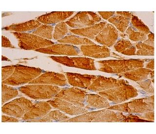 Troponin I-SS Antibody (A-12) - Immunohistochemistry - Image 333975 