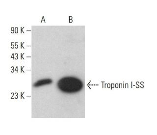 western blotting image from recommended Troponin I-SS (C-4) monoclonal antibody replacement. Image 382361