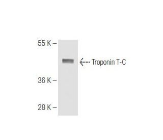 Troponin T-C Antibody (1.BB.155) - Western Blotting - Image 65798