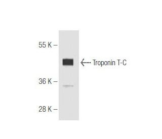 Troponin T-C Antibody (1.BB.157) - Western Blotting - Image 65801