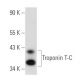 Troponin T-C Antibody (1F2) - Western Blotting - Image 14737