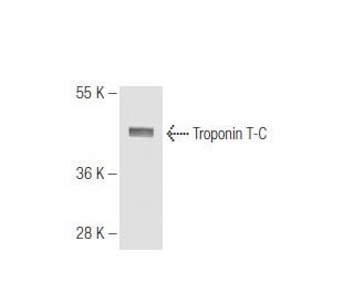 Troponin T-C Antibody (1F2) - Western Blotting - Image 65147 