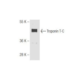 Troponin T-C Antibody (7e7) - Western Blotting - Image 65151