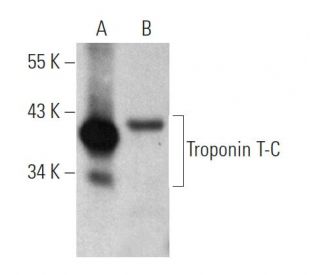 Troponin T-C Antibody (A-11) - Western Blotting - Image 372271 