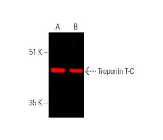 Troponin T-C Antibody (CT3) - Western Blotting - Image 381578