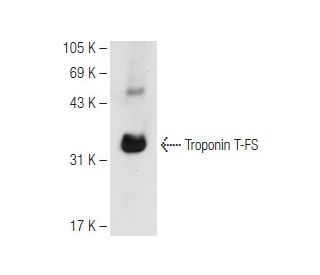 Troponin T-FS Antibody (C-12) - Western Blotting - Image 82662 