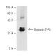 Troponin T-FS Antibody (C-12) - Western Blotting - Image 82662 