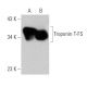 Troponin T-FS Antibody (C-12) - Western Blotting - Image 359980
