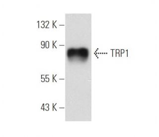 western blotting image from recommended TRP1 (G-9) monoclonal antibody replacement. Image 109605