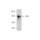 TRP1 Antibody (F-9) - Western Blotting - Image 333587