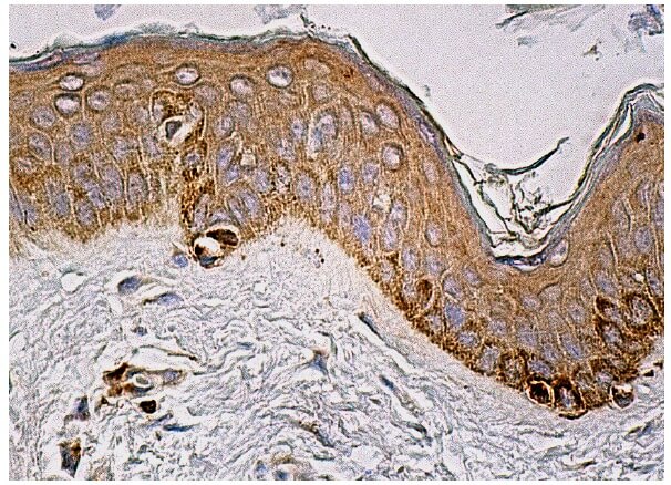 朋ページ trp1-antibody-g-9-