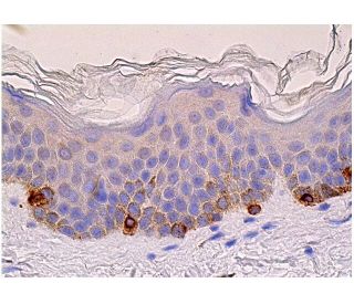 TRP1 Antibody (G-9) | SCBT - Santa Cruz Biotechnology