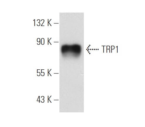 TRP1 Antibody (G-9) | SCBT - Santa Cruz Biotechnology