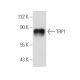 western blotting image from recommended TRP1 (G-9) monoclonal antibody replacement. Image 109605
