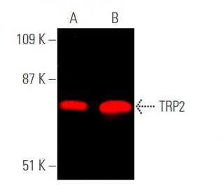 Nappyiページ dynamin-ii-antibody-g-4-