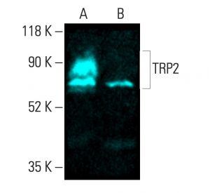 専用ページ TRP2/DCT抗体(C-9) | SCBT - Santa Cruz Biotechnology