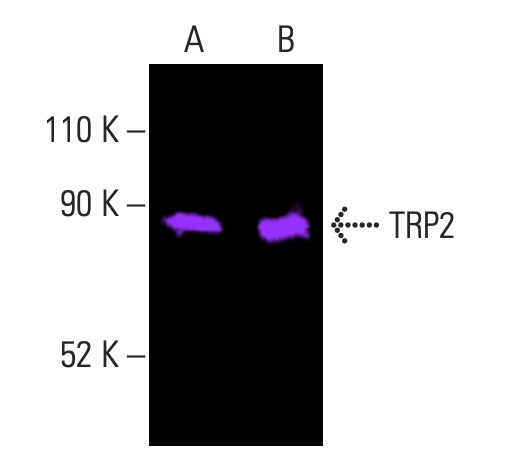 TRP2/DCT Antibody (C-9) | SCBT - Santa Cruz Biotechnology