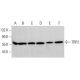 Cet anticorps polyclonal n'est plus commercialisé. Voir l'anticorps monoclonal <a href="trp2-antibody-c-9">TRP2/DCT (C-9)</a> que nous recommandons (données d'échantillonnage indiquées). western blotting image from recommended TRP2/DCT (C-9) monoclonal antibody replacement. Image 376985