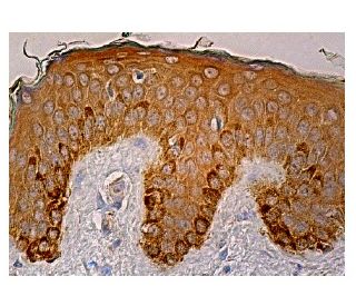 TRP2/DCT Antibody (E-10) - Immunohistochemistry - Image 159211 