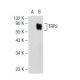 TRP2/DCT Antibody (E-10) - Western Blotting - Image 109165