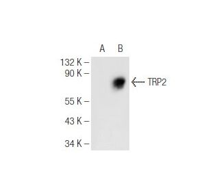 TRP2/DCT Antibody (F-9) - Western Blotting - Image 93680 