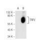 TRP2/DCT Antibody (F-9) - Western Blotting - Image 93678