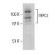 TRPC3 Antibody (C-5) - Western Blotting - Image 399354 