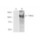 TRPC5 Antibody (1C8) - Western Blotting - Image 347583 
