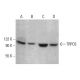 western blotting image from recommended TRPC6 (B-10) monoclonal antibody replacement. Image 376564