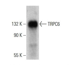 TRPC6 Antibody (E-7) - Western Blotting - Image 381019