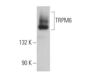 TRPM6 Antibody (D-6) - Western Blotting - Image 366898 