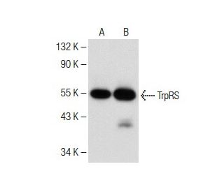 TrpRS Antibody (C-7): sc-374401