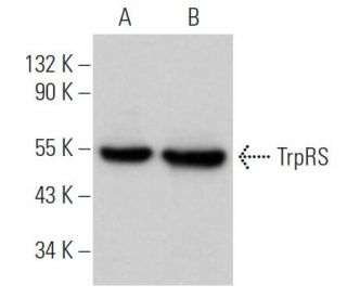 TrpRS Antibody (C-7) - Western Blotting - Image 366014
